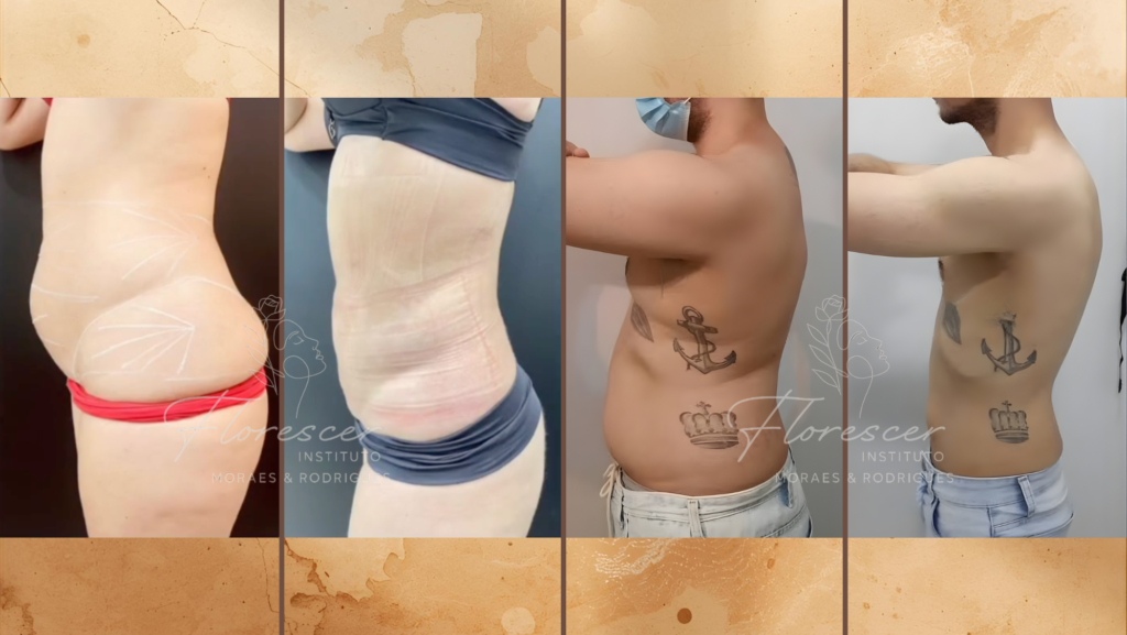 Protocolo de Emagrecimento